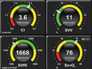 Image: The Edwards EV1000 Critical Care Platform Display (Photo courtesy of Edwards Lifesciences).